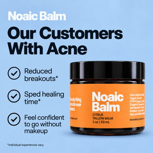 Standard Tallow Balm