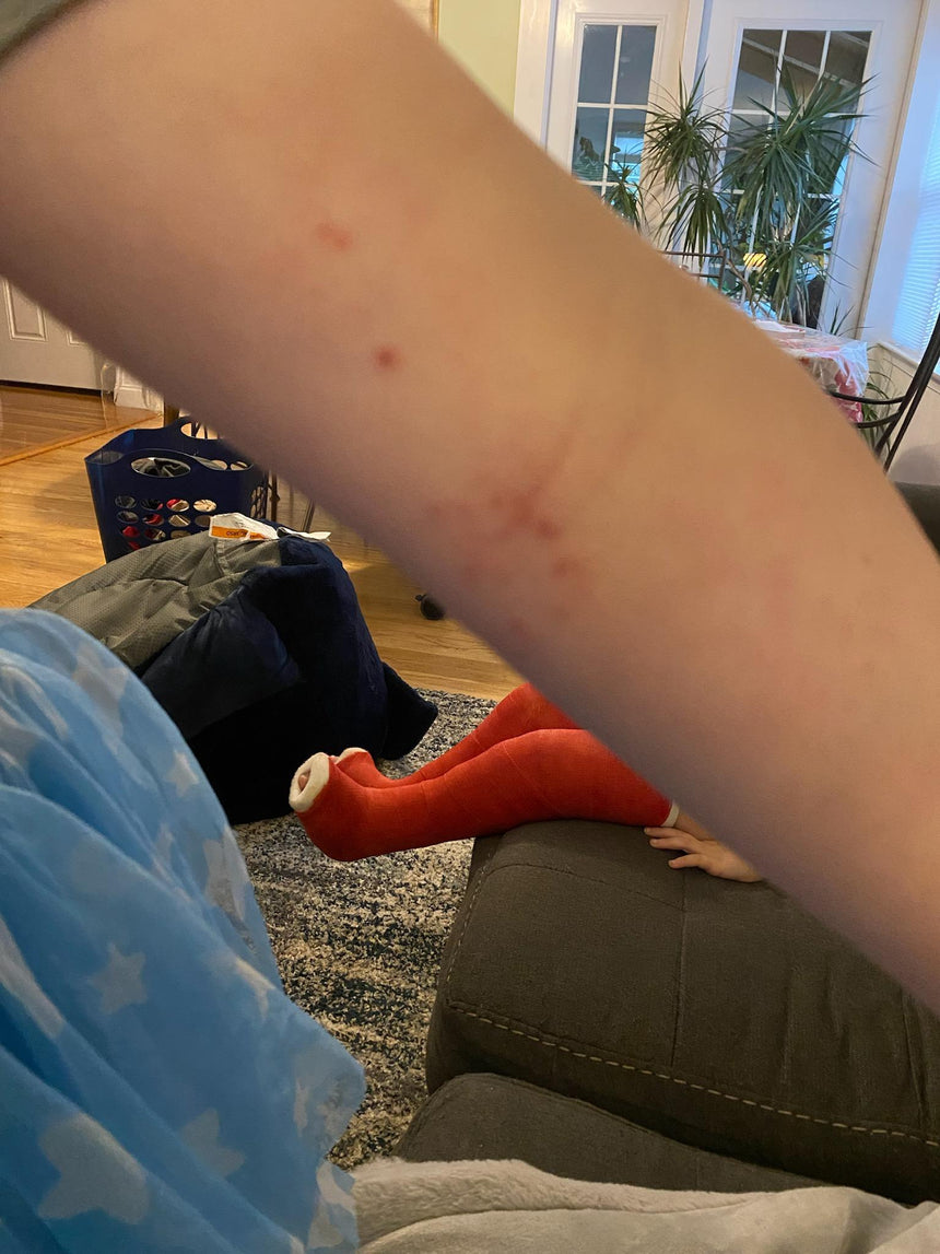 After — Problem: Eczema