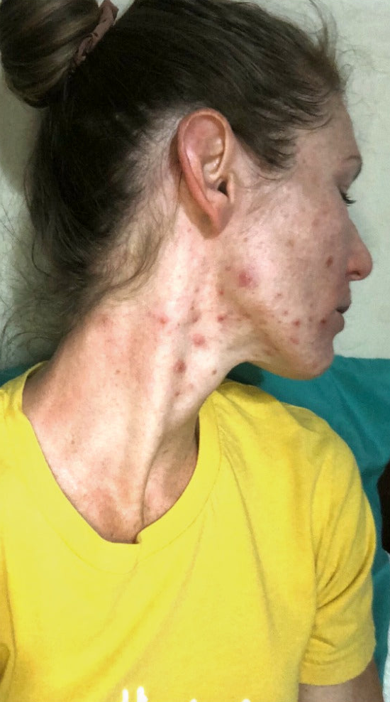 Before using Noaic Balm